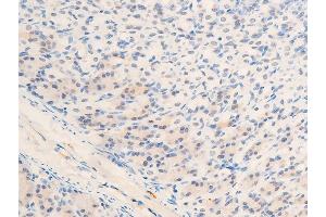 Immunohistochemistry (IHC) image for anti-Myc Proto-Oncogene protein (MYC) (pThr58) antibody (ABIN6256584)