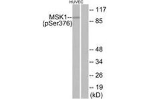 Western blot analysis of extracts from HuvEc cells treated with PMA 125ng/ml 30', using MSK1 (Phospho-Ser376) Antibody. (MSK1 Antikörper  (pSer376))