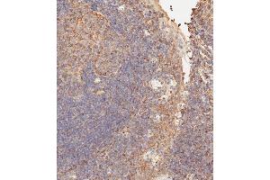 Immunohistochemistry (Paraffin-embedded Sections) (IHC (p)) image for anti-CD276 (CD276) (AA 493-522), (C-Term) antibody (ABIN656709)