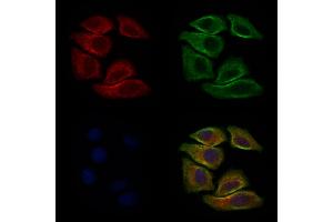 ABIN6264322 and ABIN6277635 staining Hela cells by IF/ICC. (PNMT Antikörper  (N-Term))