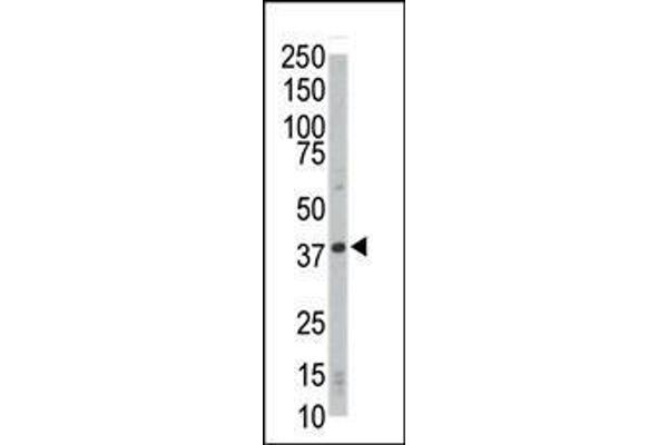 CDK4 Antikörper  (C-Term)