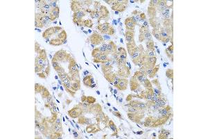Immunohistochemistry of paraffin-embedded human gastric using EIF2S3 antibody at dilution of 1:100 (x40 lens).
