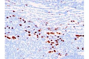 Formalin-fixed, paraffin-embedded human Tonsil stained with Macrophage L1 Protein Mouse Monoclonal Antibody (MAC387) (S100A8 Antikörper)