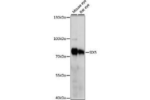 Western blot analysis of extracts of various cell lines, using SIX5 antibody (ABIN7267777) at 1000 dilution. (Six5 Antikörper  (AA 1-170))
