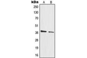Western blot analysis of MRPL3 expression in HeLa (A), A549 (B) whole cell lysates. (MRPL3 Antikörper  (Center))