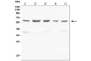 Western blot analysis of C9ORF72 using anti-C9ORF72 antibody (ABIN7603124).