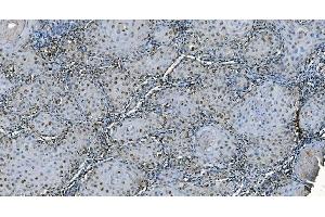 IHC analysis of CDC45L using anti-CDC45L antibody (ABIN7600230). (CDC45 Antikörper  (AA 166-431))