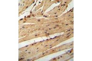 Immunohistochemistry analysis in mouse heart tissue (Formalin-fixed, Paraffin-embedded) using LARP6  Antibody (N-term),  followed by peroxidase conjugation of the secondary antibody and DAB staining.