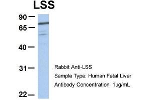 Host:  Rabbit  Target Name:  RIOK3  Sample Type:  Human Fetal Heart  Antibody Dilution:  1. (RIOK3 Antikörper  (C-Term))
