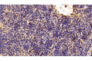 Detection of TIGIT in Mouse Spleen Tissue using Polyclonal Antibody to T-Cell Immunoreceptor With Ig And ITIM Domains Protein (TIGIT) (TIGIT Antikörper  (AA 28-246))
