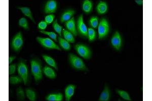 Immunofluorescence staining of A549 cells with ABIN7174093 at 1:100, counter-stained with DAPI.