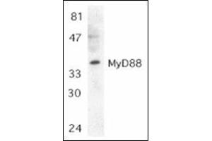 Western blot analysis of MyD88 in Jurkat whole cell lysate with this product at 1:500 dilution. (MYD88 Antikörper  (C-Term))