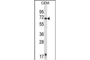 Western blot analysis in CEM cell line lysates (35ug/lane). (HRH1 Antikörper  (AA 273-301))