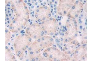 DAB staining on IHC-P; Samples: Rat Kidney Tissue (FLT1 Antikörper  (AA 303-524))