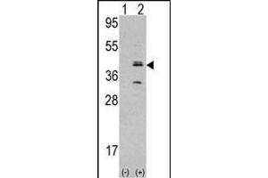 Western blot analysis of MVK (arrow) using rabbit polyclonal MVK Antibody (N-term) (ABIN392802 and ABIN2842240). (MVP Antikörper  (N-Term))