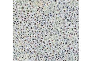 IHC analysis of DCK using anti-DCK antibody (ABIN5693016). (DCK Antikörper  (AA 17-260))