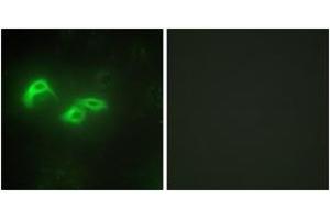 Immunofluorescence analysis of HepG2 cells, using TFAM Antibody. (TFAM Antikörper  (AA 131-180))