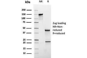 SDS-PAGE (SDS) image for anti-Keratin 20 (KRT20) (AA 196-323) antibody (ABIN6940351)