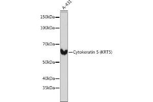 Western blot analysis of extracts of A-431 cells, using Cytokeratin 5 (KRT5) (KRT5) Rabbit mAb (ABIN7268103) at 1:1000 dilution. (Cytokeratin 5 Antikörper)