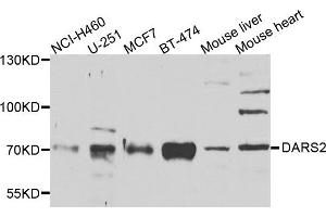 Western blot analysis of extracts of various cells, using DARS2 antibody. (DARS2 Antikörper)