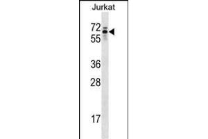 TROVE2 Antibody (C-term) (ABIN1537371 and ABIN2848873) western blot analysis in Jurkat cell line lysates (35 μg/lane). (TROVE2 Antikörper  (C-Term))