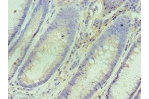 Immunohistochemistry (IHC) image for anti-Interleukin 1 Receptor Antagonist (IL1RN) (AA 22-230) antibody (ABIN7156763)