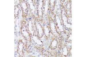Immunohistochemistry (IHC) image for anti-Methylenetetrahydrofolate Dehydrogenase (NADP+ Dependent) 2, Methenyltetrahydrofolate Cyclohydrolase (MTHFD2) (AA 40-250) antibody (ABIN6144144)