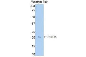 Western Blotting (WB) image for anti-Growth Arrest-Specific 6 (GAS6) (AA 356-511) antibody (ABIN3209078) (GAS6 Antikörper  (AA 356-511))