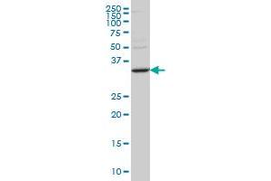 STAU2 monoclonal antibody (M10), clone 2C8 Western Blot analysis of STAU2 expression in SW-13 . (Double-stranded RNA-binding protein Staufen homolog 2 (STAU2) (AA 2-90) Antikörper)