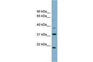 Image no. 1 for anti-N-6 Adenine-Specific DNA Methyltransferase 1 (Putative) (N6AMT1) (N-Term) antibody (ABIN6743395) (N6AMT1 Antikörper  (N-Term))
