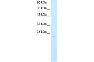 Western Blot showing SP140 antibody used at a concentration of 5. (SP140 Antikörper  (N-Term))