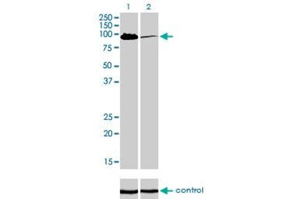 MCC Antikörper  (AA 31-130)