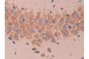 Detection of MUC1 in Mouse Cerebrum Tissue using Polyclonal Antibody to Mucin 1 (MUC1) (MUC1 Antikörper  (AA 410-525))