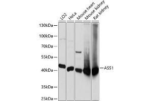 Western blot analysis of extracts of various cell lines, using  antibody  at 1:3000 dilution. (ASS1 Antikörper  (AA 1-412))