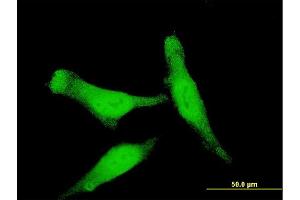 Immunofluorescence of monoclonal antibody to SMAD7 on HeLa cell.