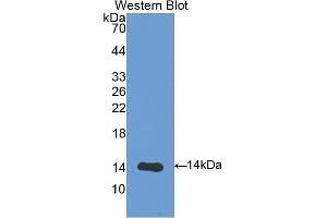 Western Blotting (WB) image for anti-V-Set Domain Containing T Cell Activation Inhibitor 1 (VTCN1) (AA 34-147) antibody (ABIN1176799) (VTCN1 Antikörper  (AA 34-147))