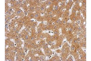 Immunohistochemistry (IHC) image for anti-Plasminogen (PLG) antibody (ABIN2855505)