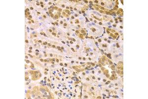 Immunohistochemistry (IHC) image for anti-Mitogen-Activated Protein Kinase Kinase 7 (MAP2K7) (AA 1-250) antibody (ABIN6219416) (MAP2K7 Antikörper  (AA 1-250))