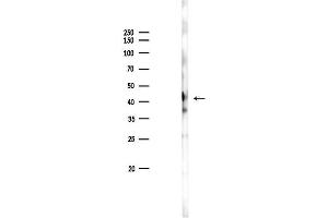 Western blot analysis of lysates from Rat brain, using CYLC2 Antibody at 1/1000 dilution.