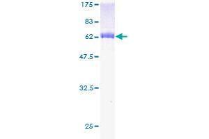 WDR45 Protein (AA 1-360) (GST tag)