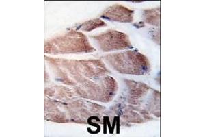 Immunohistochemistry (Paraffin-embedded Sections) (IHC (p)) image for anti-Ribosomal Protein S6 Kinase, 90kDa, Polypeptide 3 (RPS6KA3) (AA 13-42), (N-Term) antibody (ABIN392457)