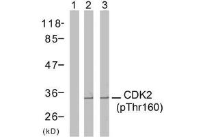 Western blot analysis of extracts from A2780 cells (Lane 1 and 2) and MDA-MB-435 cells (Lane 3), using CDK2 (phospho-Thr160) antibody (E011133). (CDK2 Antikörper  (pThr160))