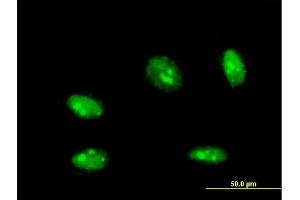 Immunofluorescence of monoclonal antibody to NANOG on HeLa cell. (Nanog Antikörper  (AA 98-195))