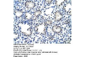 Immunohistochemistry (IHC) image for anti-Nuclear Receptor Subfamily 2, Group C, Member 1 (NR2C1) (C-Term) antibody (ABIN2780499)