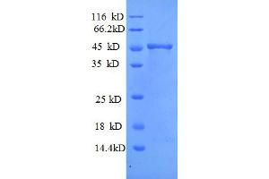 SDS-PAGE (SDS) image for Matrix Metallopeptidase 7 (Matrilysin, Uterine) (MMP7) (AA 95-267) protein (GST tag) (ABIN5712530)