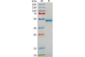 Human IL18 Protein, hFc Tag on SDS-PAGE under reducing condition.