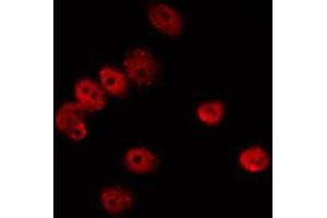 ABIN6275735 staining LOVO by IF/ICC. (Crossover junction endonuclease EME1 (EME1) (Internal Region) Antikörper)