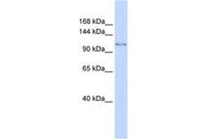 Image no. 1 for anti-Jumonji C Domain-Containing Histone Demethylase 1 Homolog D (JHDM1D) (AA 288-337) antibody (ABIN6744253) (JHDM1D Antikörper  (AA 288-337))