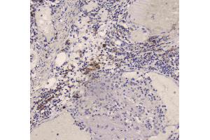 IHC analysis of DC-SIGN using anti-DC-SIGN antibody . (DC-SIGN/CD209 Antikörper)