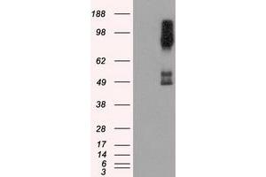 Image no. 4 for anti-B-Raf proto-oncogene, serine/threonine kinase (BRAF) antibody (ABIN1496952) (BRAF Antikörper)